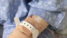 三方活栓による皮膚の発赤を防止するクッションシートの活用